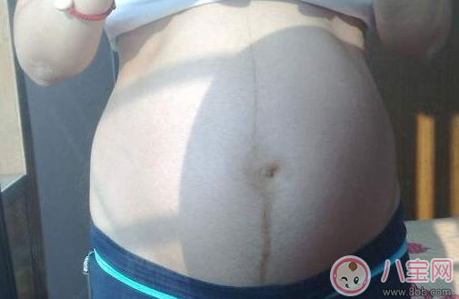 怎么通過(guò)妊娠紋判斷懷的是男是女    妊娠紋判斷性別方法