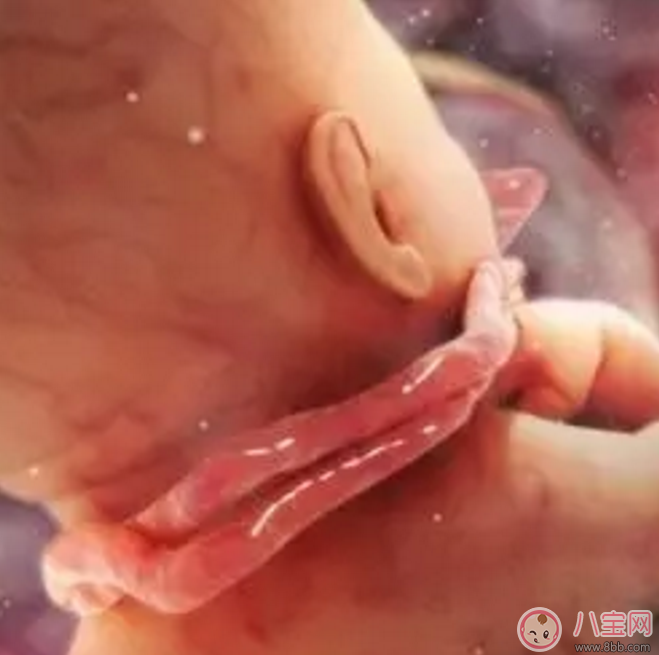 胎兒臍帶繞頸怎么辦？產(chǎn)前怎樣化解臍帶繞頸？