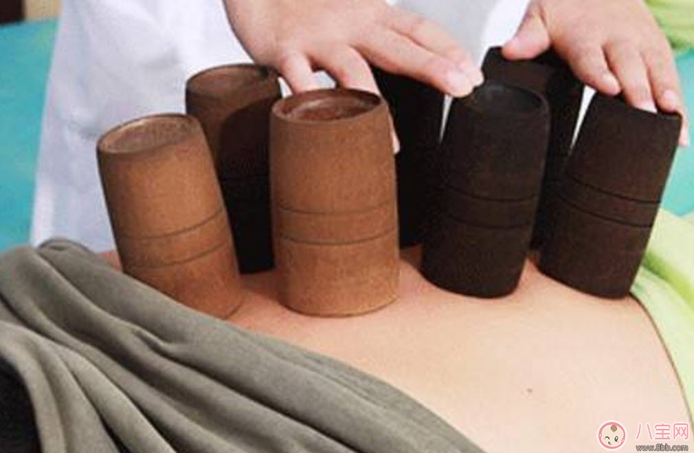 孕婦拔火罐可以嗎 孕婦肩膀能拔火罐嗎(孕婦拔過火罐怎么辦)