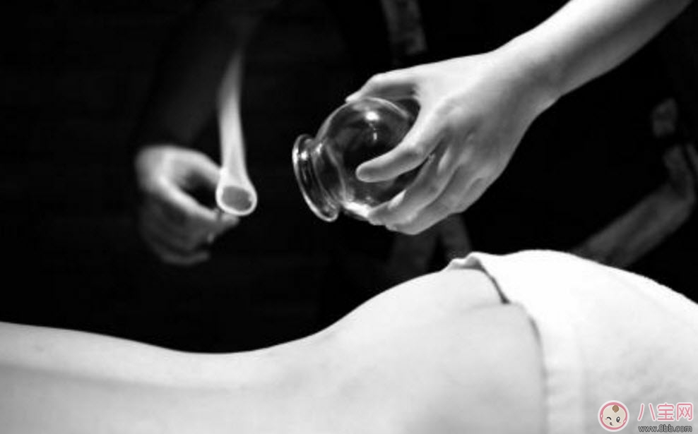 孕婦拔火罐可以嗎 孕婦肩膀能拔火罐嗎(孕婦拔過火罐怎么辦)