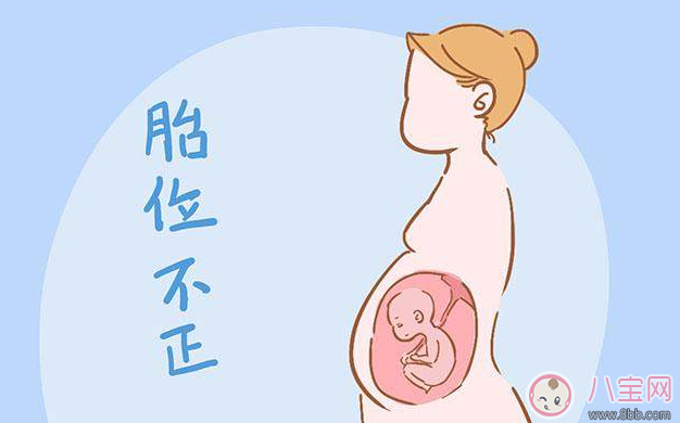 分娩是選順產(chǎn)還是剖腹產(chǎn) 醫(yī)生往往會參考這些數(shù)據(jù)