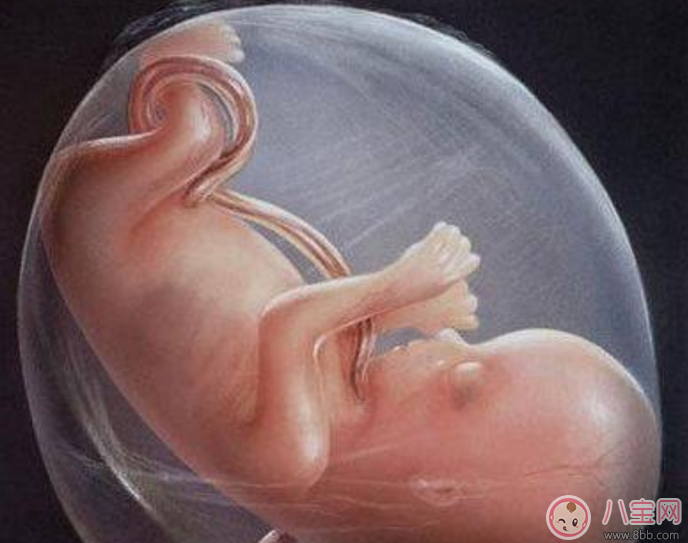 臍帶繞頸怎么辦 嬰兒臍帶繞頸嚴重嗎 臍帶繞頸怎么辦 嬰兒臍帶繞頸嚴重嗎