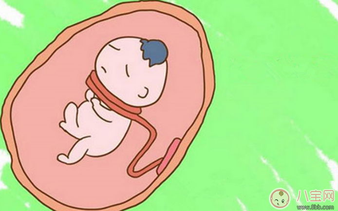 臍帶繞頸怎么辦 嬰兒臍帶繞頸嚴重嗎 臍帶繞頸怎么辦 嬰兒臍帶繞頸嚴重嗎