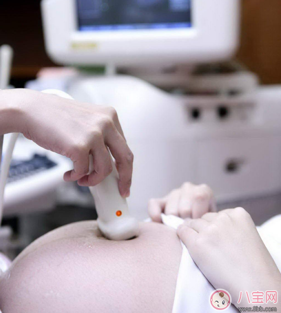 懷孕做B超怎么看 自己看懂B超單方法