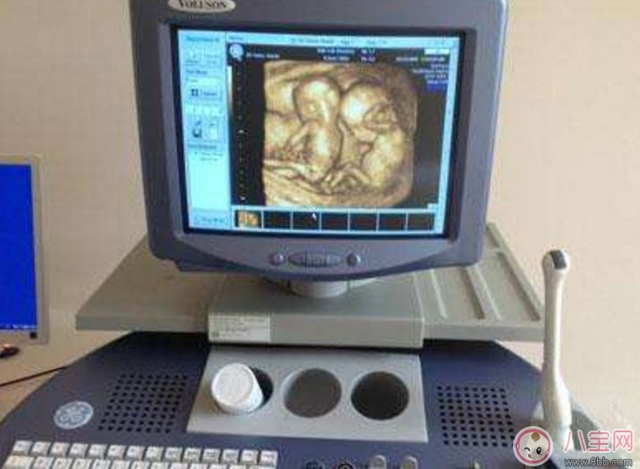 孕婦四維彩超的最佳時(shí)間 孕婦一定要做四維彩超嗎