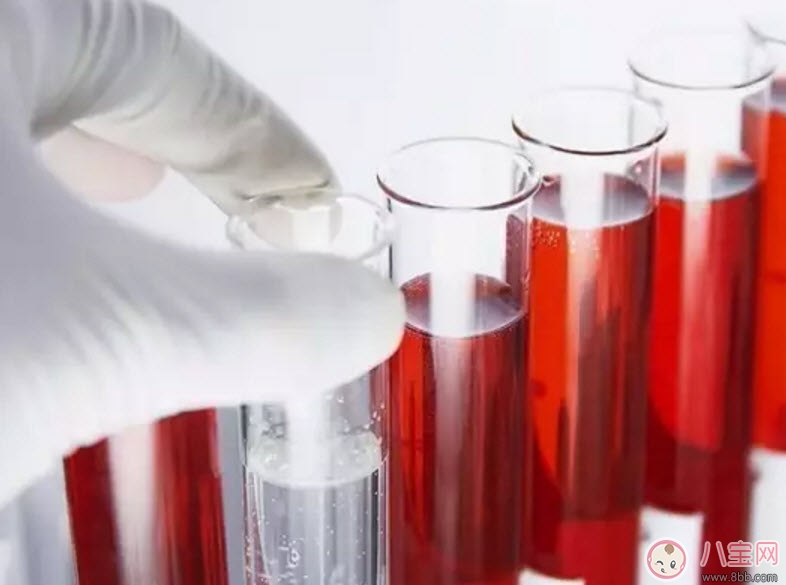 孕婦為什么要驗(yàn)血型 哪些孕婦需要確定血型