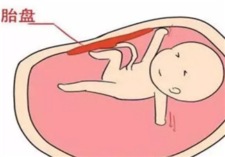 胎盤三級就已經(jīng)老化了嗎 胎盤老化判斷標(biāo)準(zhǔn)