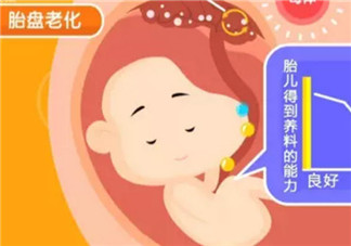 孕晚期補鈣會導(dǎo)致胎盤老化嗎 孕晚期補鈣會不會導(dǎo)致胎盤老化