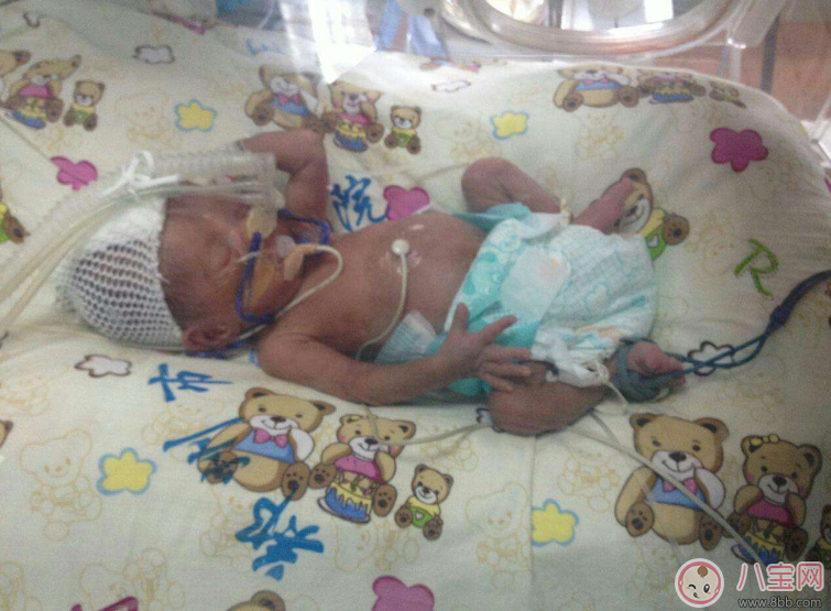 哪些準媽媽容易早產(chǎn) 早產(chǎn)準媽媽特征