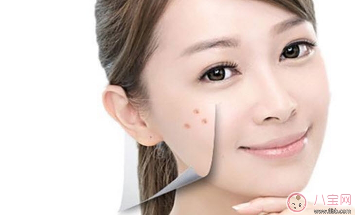 孕婦孕期長痘痘怎么辦 孕期痘痘怎么調(diào)理(長痘痘吃什么)
