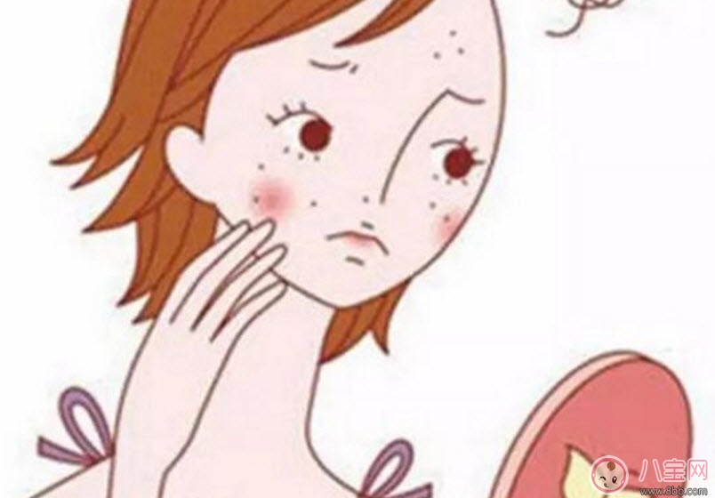 孕婦孕期長痘痘怎么辦 孕期痘痘怎么調(diào)理(長痘痘吃什么)