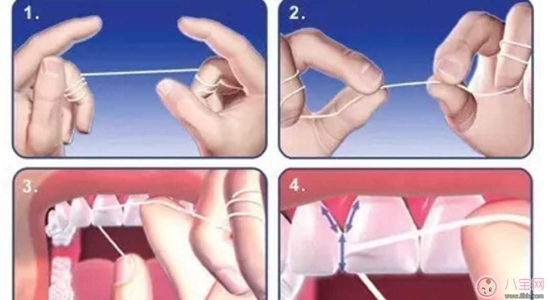 孕期牙齦出血 如何自己保健恢復