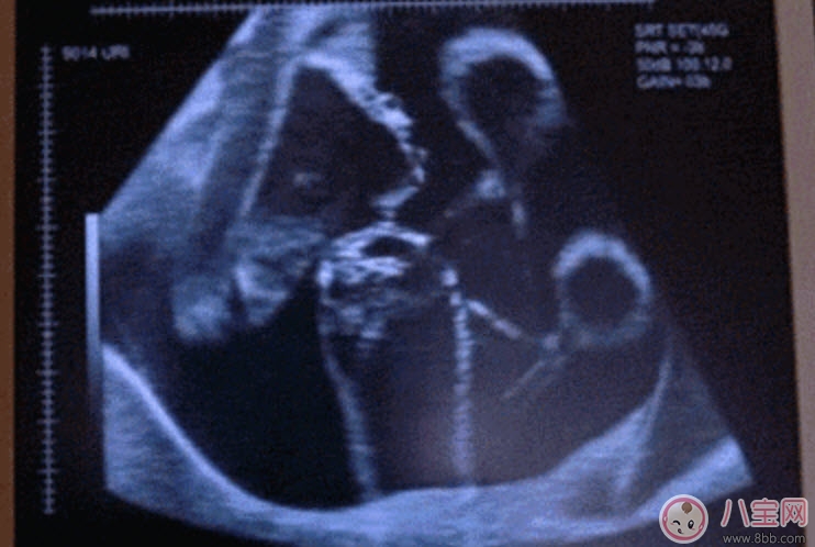 孕晚期胎動(dòng)頻繁正常嗎 孕晚期胎動(dòng)時(shí)間