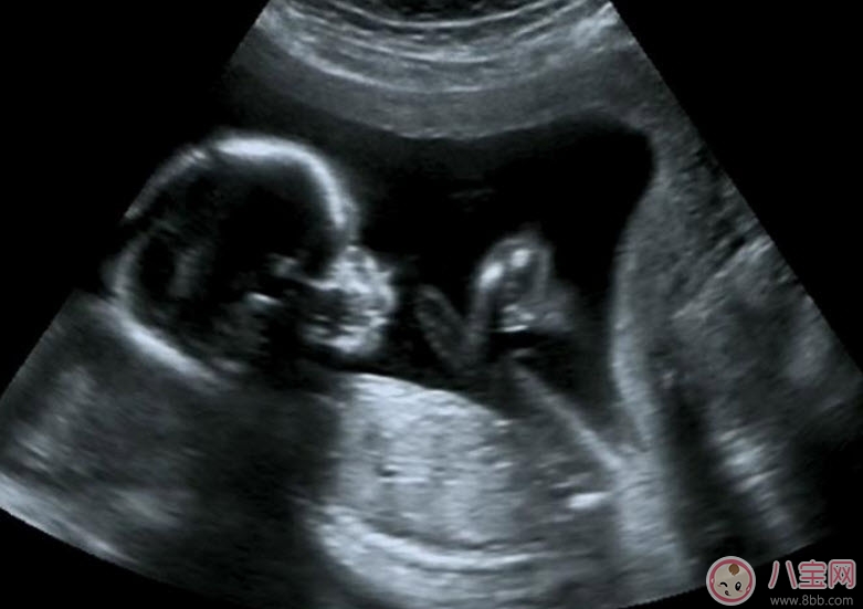 孕早期做陰道B超會(huì)影響胎兒?jiǎn)?陰式b超和b超的區(qū)別