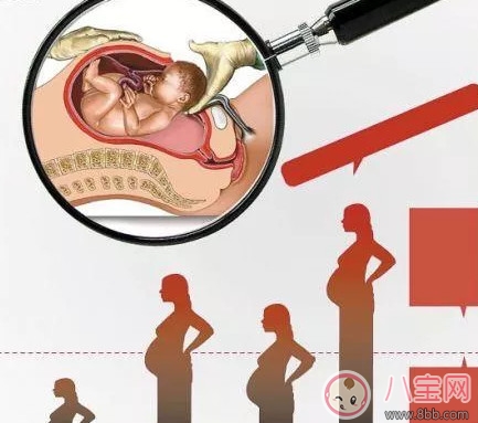 剖腹產(chǎn)孕婦會不會感到疼痛 剖腹產(chǎn)橫剖還是縱剖。