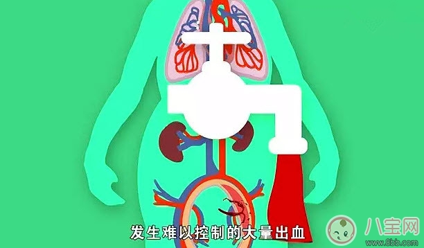 哪些人更容易產(chǎn)后出血 產(chǎn)后出血發(fā)病癥狀(如何預防產(chǎn)后大出血)