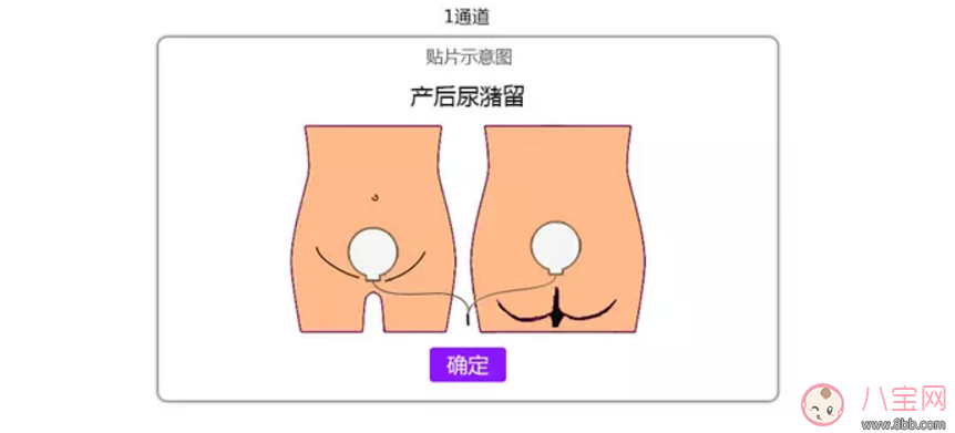 產后排尿難的原因  如何促進排尿