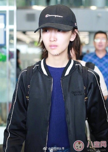 周冬雨下巴為什么會出現(xiàn)疤痕 周冬雨下巴受傷的原因