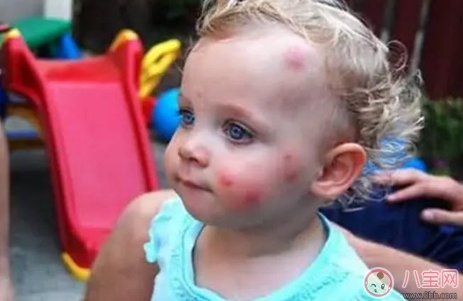 夏天寶寶驅蚊方法大全 寶寶驅蚊成分哪種安全有效