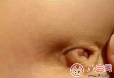 孩子肚臍臟了怎么辦 就算你有強(qiáng)迫癥也不能摳