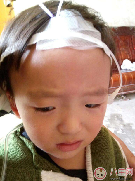 秋季腹瀉孩子狀態(tài)差 及時預(yù)防遠(yuǎn)離它