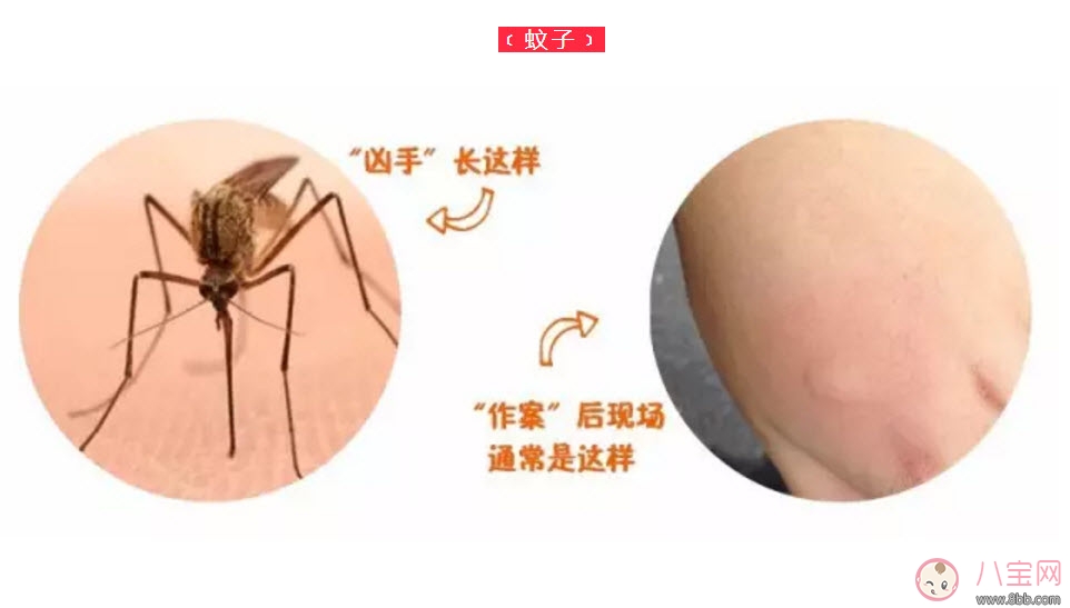 寶寶螨蟲過敏怎么辦，寶寶被螨蟲咬和蚊子咬癥狀對比圖片區(qū)別