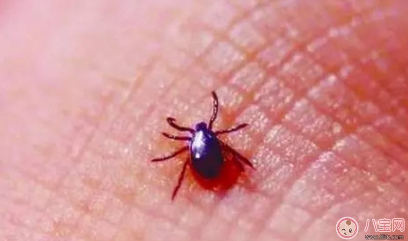 寶寶被蜱蟲咬了癥狀圖片 寶寶被蜱蟲咬和蚊子咬癥狀對比圖片區(qū)別