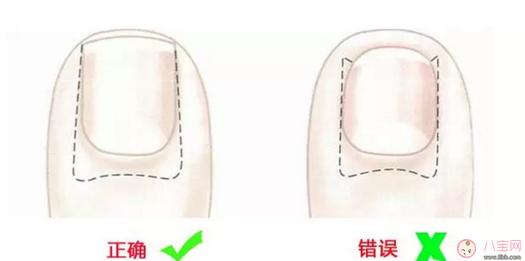 給寶寶剪指甲如何避免錯誤 如何正確的給寶寶剪指甲