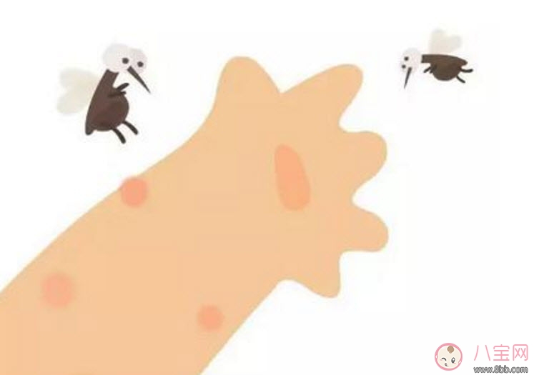 寶寶被臭蟲咬了癥狀圖片 寶寶被臭蟲咬和蚊子咬癥狀對(duì)比圖片區(qū)別