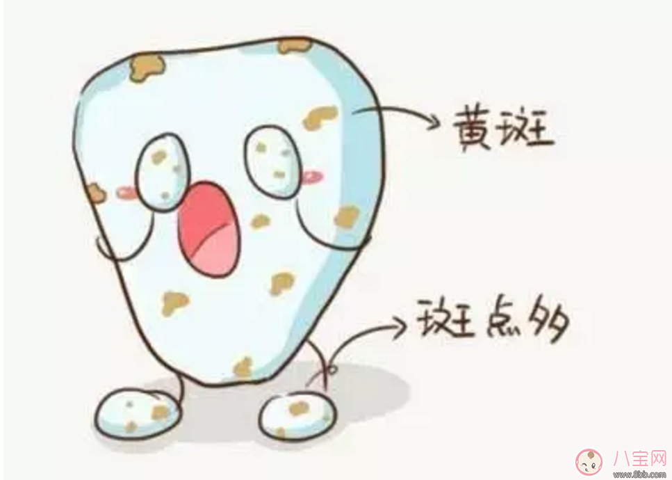 寶寶沒有齲齒 卻有黑牙是怎么回事？