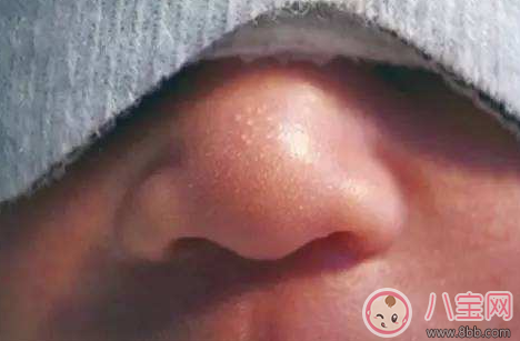 新生兒鼻尖上起了好多小白點(diǎn)是什么 寶寶鼻子上有小白點(diǎn) 新生兒鼻尖上起了好多小白點(diǎn)是什么 寶寶鼻子上有小白點(diǎn)