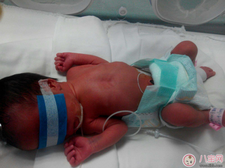早產(chǎn)寶寶太小怎么照顧 各項(xiàng)注意到一樣是個(gè)健康寶寶 早產(chǎn)寶寶太小怎么照顧 各項(xiàng)注意到一樣是個(gè)健康寶寶