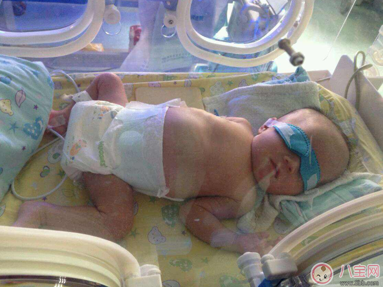早產(chǎn)寶寶太小怎么照顧 各項(xiàng)注意到一樣是個(gè)健康寶寶 早產(chǎn)寶寶太小怎么照顧 各項(xiàng)注意到一樣是個(gè)健康寶寶