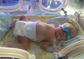 早產(chǎn)寶寶太小怎么照顧 各項(xiàng)注意到一樣是個(gè)健康寶寶