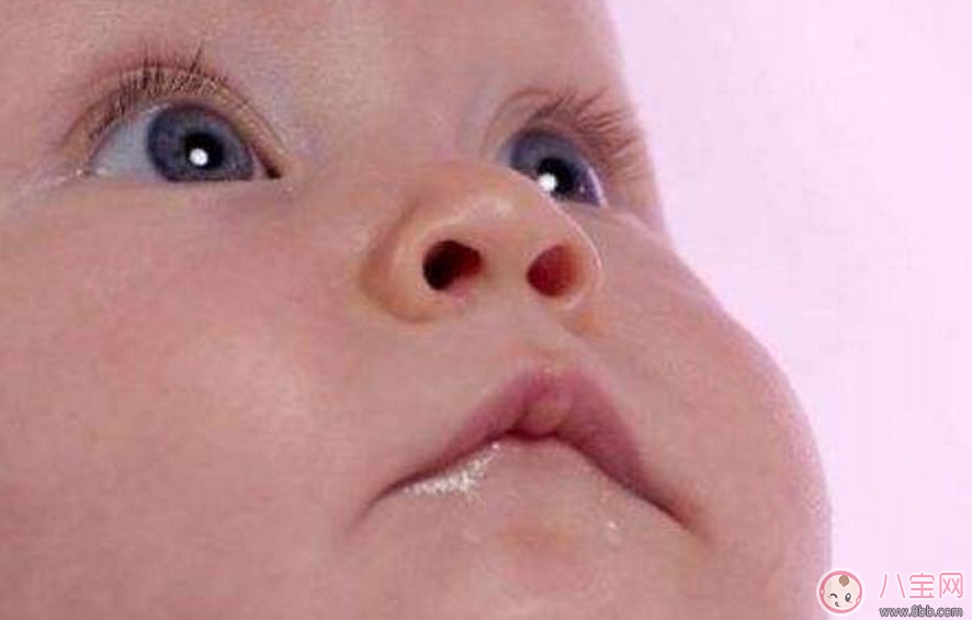 寶寶斜視手術(shù)風(fēng)險大嗎 寶寶斜視一定要做手術(shù)嗎