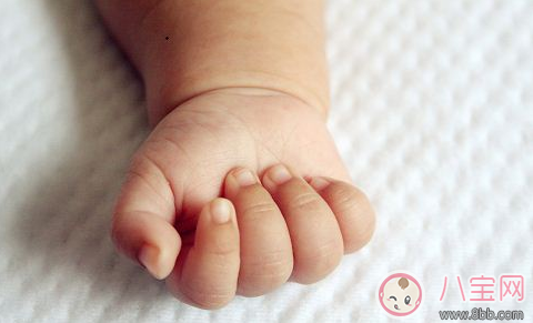 孩子手上長倒刺 寶媽應該這么做