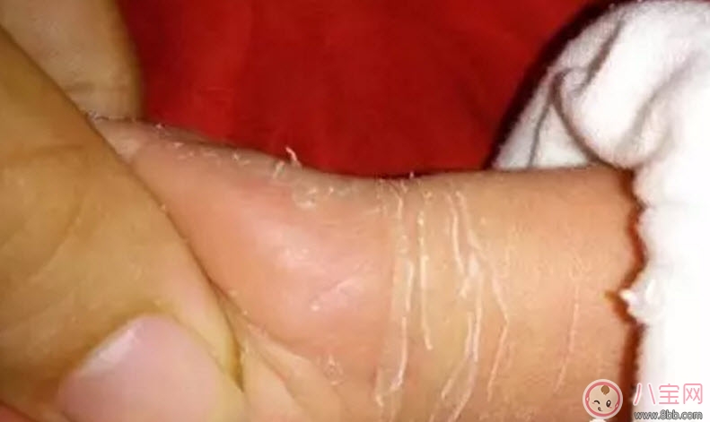新生兒手腳脫皮要多久 新生兒脫皮怎么護(hù)理(能搽點(diǎn)什么)