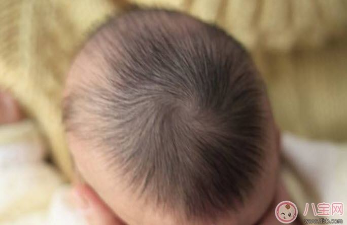 夏天寶寶出汗多是什么原因 寶寶出汗和虛汗的區(qū)別