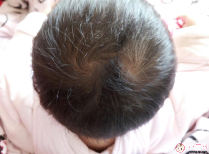 孩子頭上的旋有什么含義 幾個旋比較聰明