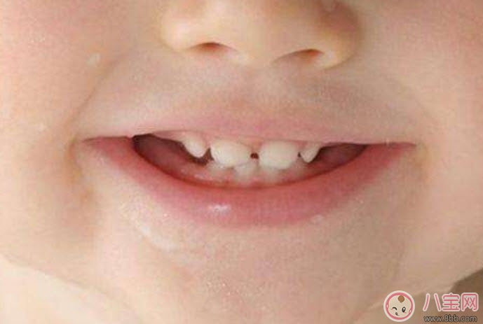 寶寶長(zhǎng)牙順序 寶寶長(zhǎng)牙特征(寶寶長(zhǎng)牙癥狀)