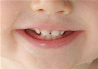 寶寶長(zhǎng)牙順序 寶寶長(zhǎng)牙特征(寶寶長(zhǎng)牙癥狀)