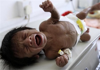 孩子這種情況居然是營(yíng)養(yǎng)不良的暗示 快給孩子調(diào)整過(guò)來(lái)