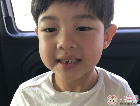 孩子出牙晚是福氣好嗎 哪些情況會影響孩子出牙 孩子出牙晚是福氣好嗎 哪些情況會影響孩子出牙