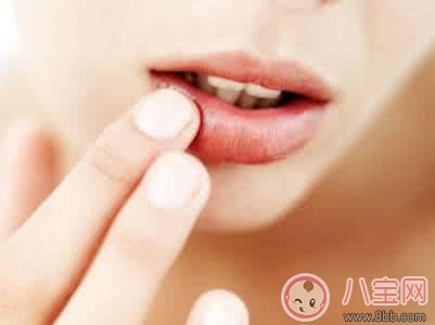 夏季孕婦上火嘴唇起泡的原因 如何治療