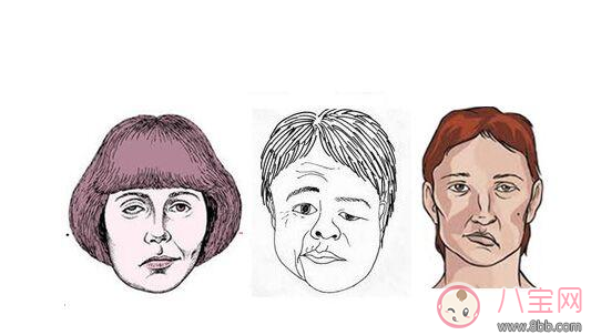 兒童吹空調(diào)竟然導(dǎo)致面癱 如何正確吹空調(diào) 兒童吹空調(diào)竟然導(dǎo)致面癱 如何正確吹空調(diào)