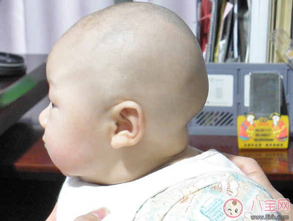 寶寶頭型塑造方法 2017寶寶頭型塑造注意事項