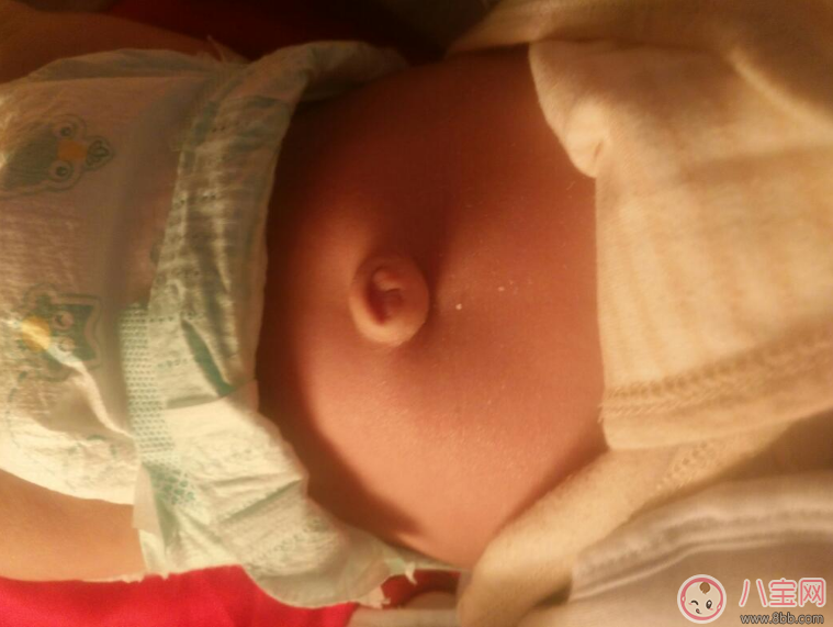 寶寶肚臍護理有方法 三不要方法要記牢