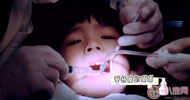 董潔兒子頂頂四顆蛀牙 寶寶更易患蛀牙問題