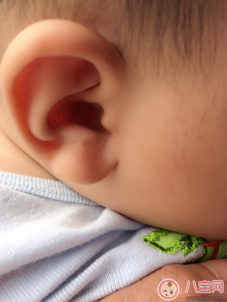 寶寶耳朵臟了要洗嗎 正確清潔耳朵方法