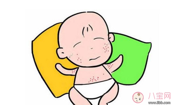 2017夏天孩子長痱子有什么偏方 去治痱子偏方有哪些